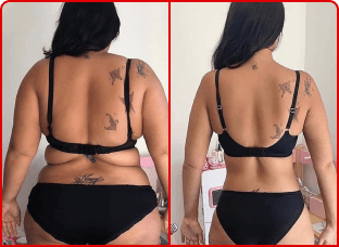 Before and after image showing a woman's weight loss transformation