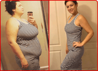 Weight Loss Transformation Woman Striped Dress